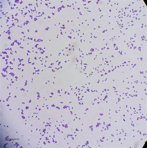 streptococcus pneumoniae microscopic image